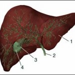 REMOVING GALLSTONES NATURALLY by Dr Lai Chiu-Nan