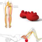 Pelvis Problem by Dr. John Bergman and Sciatica/Lower Back Pain by Brett Rodgers